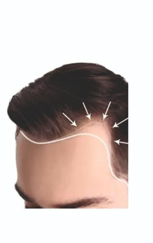 FGE Plus Hair Growth Spray 50 ml each Pack of 2